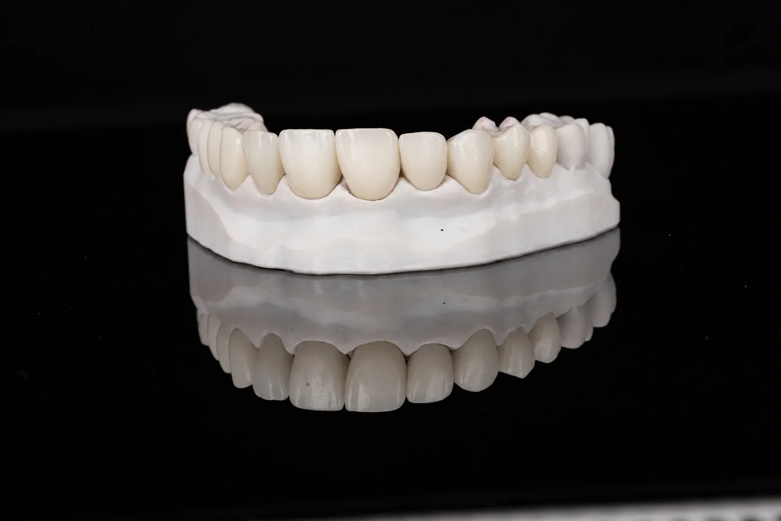 Zirconia crowns on a dental model, frontal view